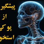 پیشگیری از پوکی استخوان