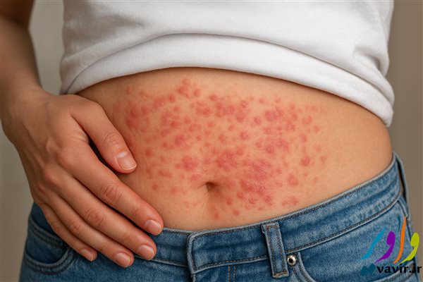 عوارض تداخلات دارویی گیاهی