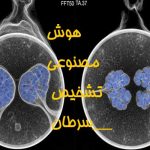 هوش مصنوعی تشخیص سرطان